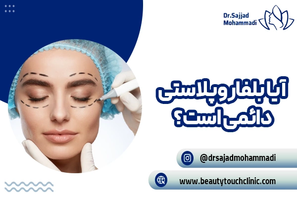 آیا بلفاروپلاستی دائمی است؟ | عوامل موثر بر طول عمر بلفاروپلاستی