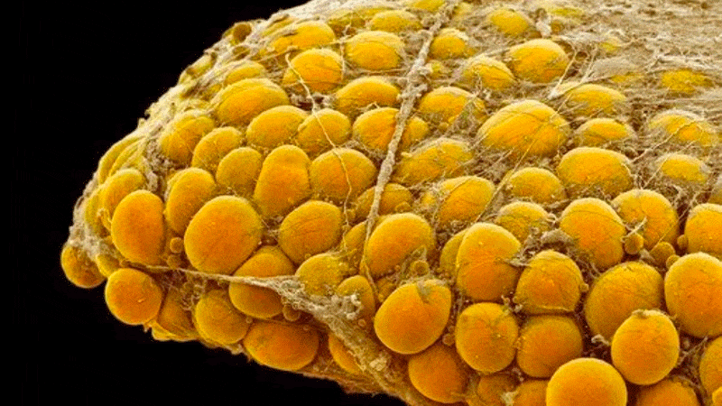 دور حقن الخلايا الوسيطة الدهنية في علاج الندبات