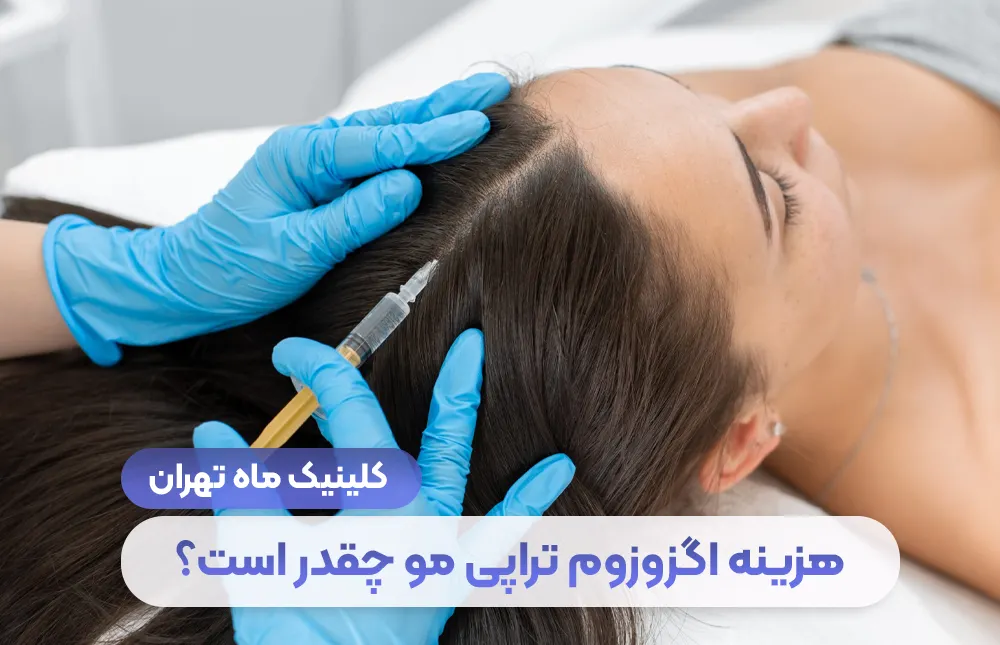 التكلفة الجديدة لعلاج اكسوسوم الشعر عام 1404 - عيادة طهران ماه