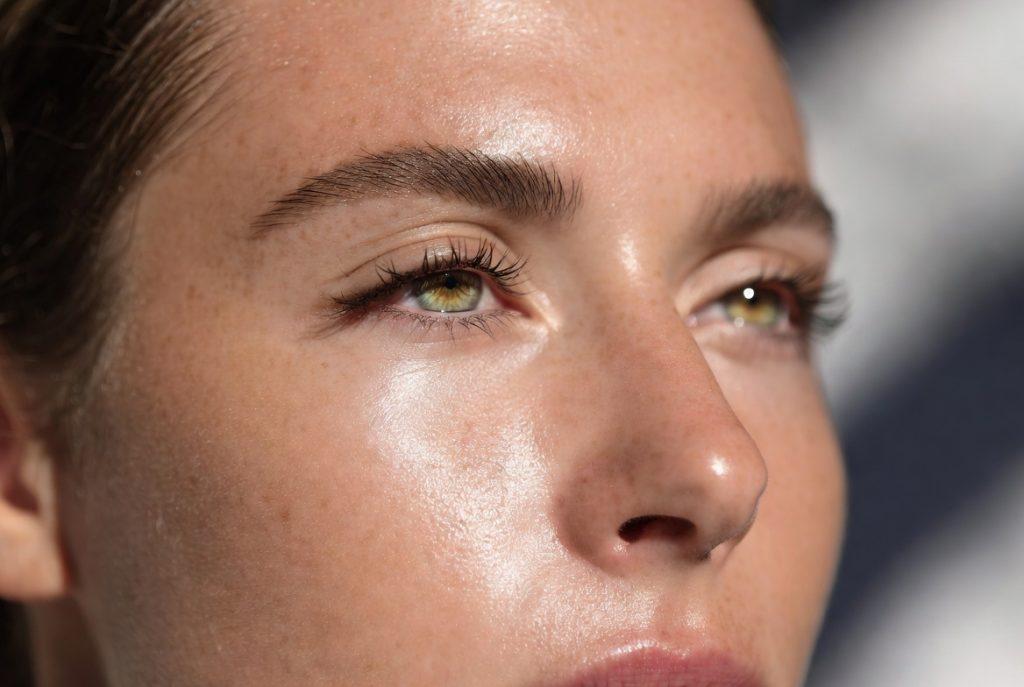 Comparative analysis of gel injection (filler) and mesogel: expert approach for rejuvenation in Moghadis Ardabili - Dr. Vida Shakiba Beauty Clinic | Zafaranieh and Sadeghieh, Tehran