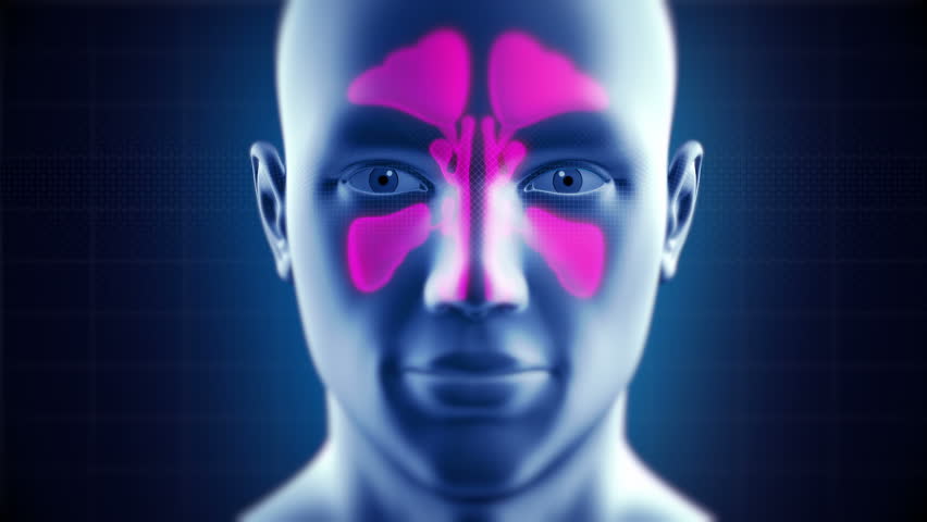 Chronic sinusitis - Dr. Jafari