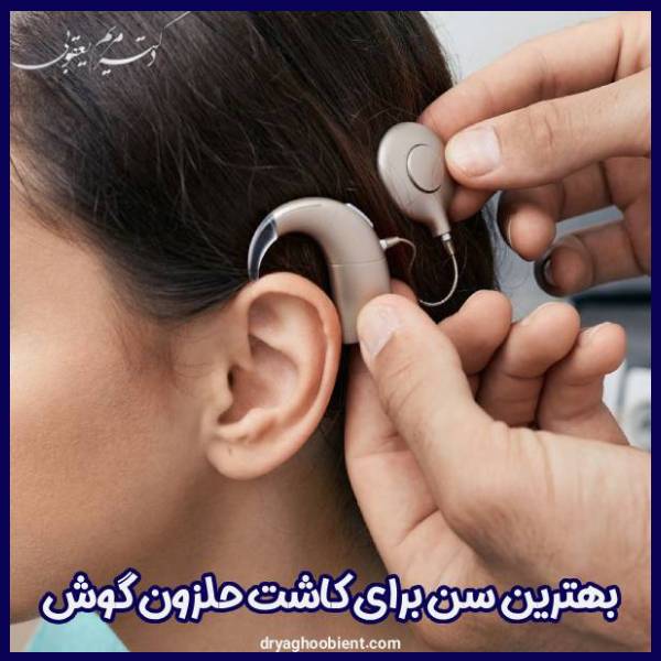 Suitable age for cochlear implantation in children and adults