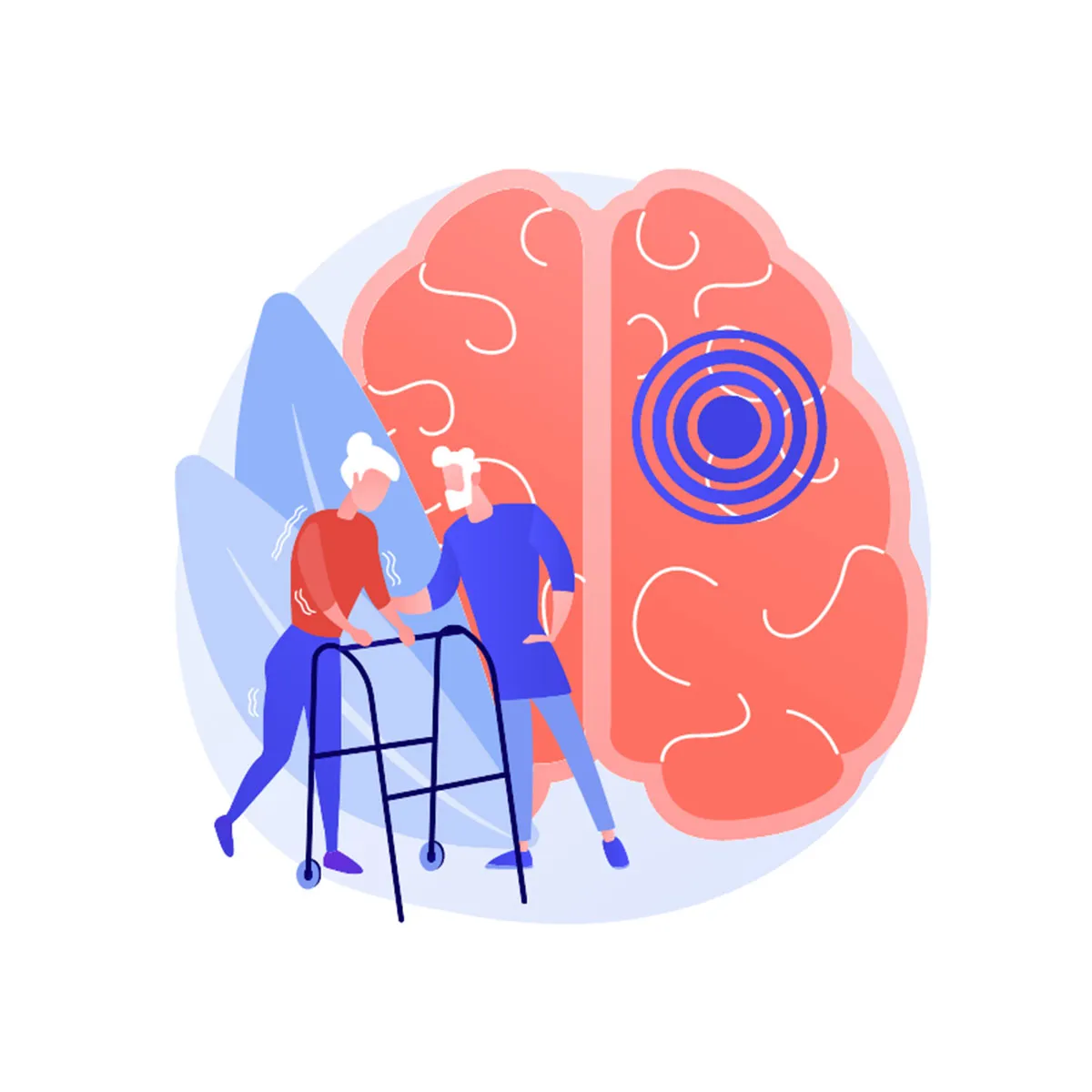 What is atypical parkinsonism and how is it treated?