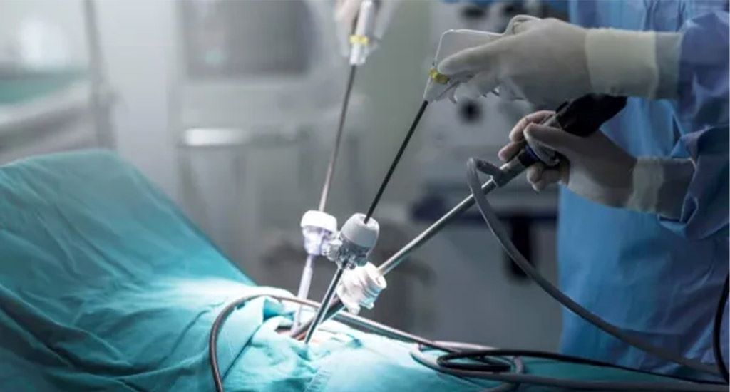 The best laparoscopic surgeon in North Tehran