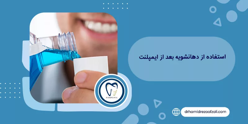 استخدام غسول الفم بعد زراعة الأسنان الدكتور حميد رضا أفضلي