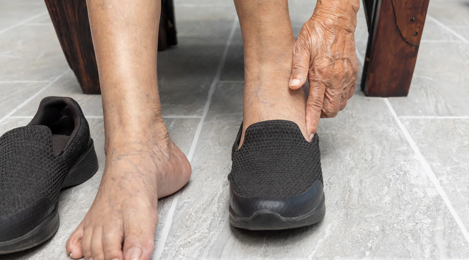 Important points when choosing medical shoes for diabetics