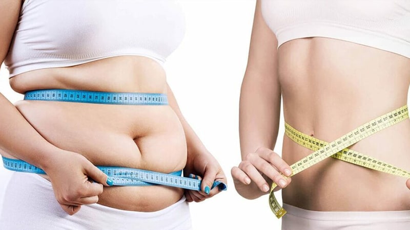 لیپوساکشن اولتراسونیک چیست؟