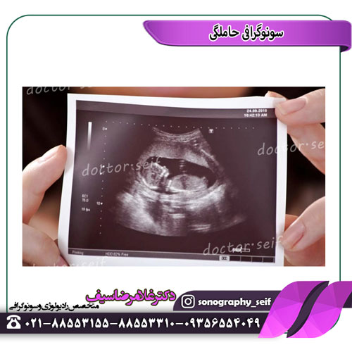 الحمل بالموجات فوق الصوتية