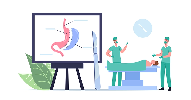 سبب عدم فقدان الوزن بعد عملية تحويل مسار المعدة