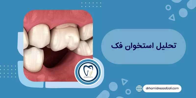 لماذا يحدث فقدان عظام الفك؟ | دكتور حميدرضا أفضلي