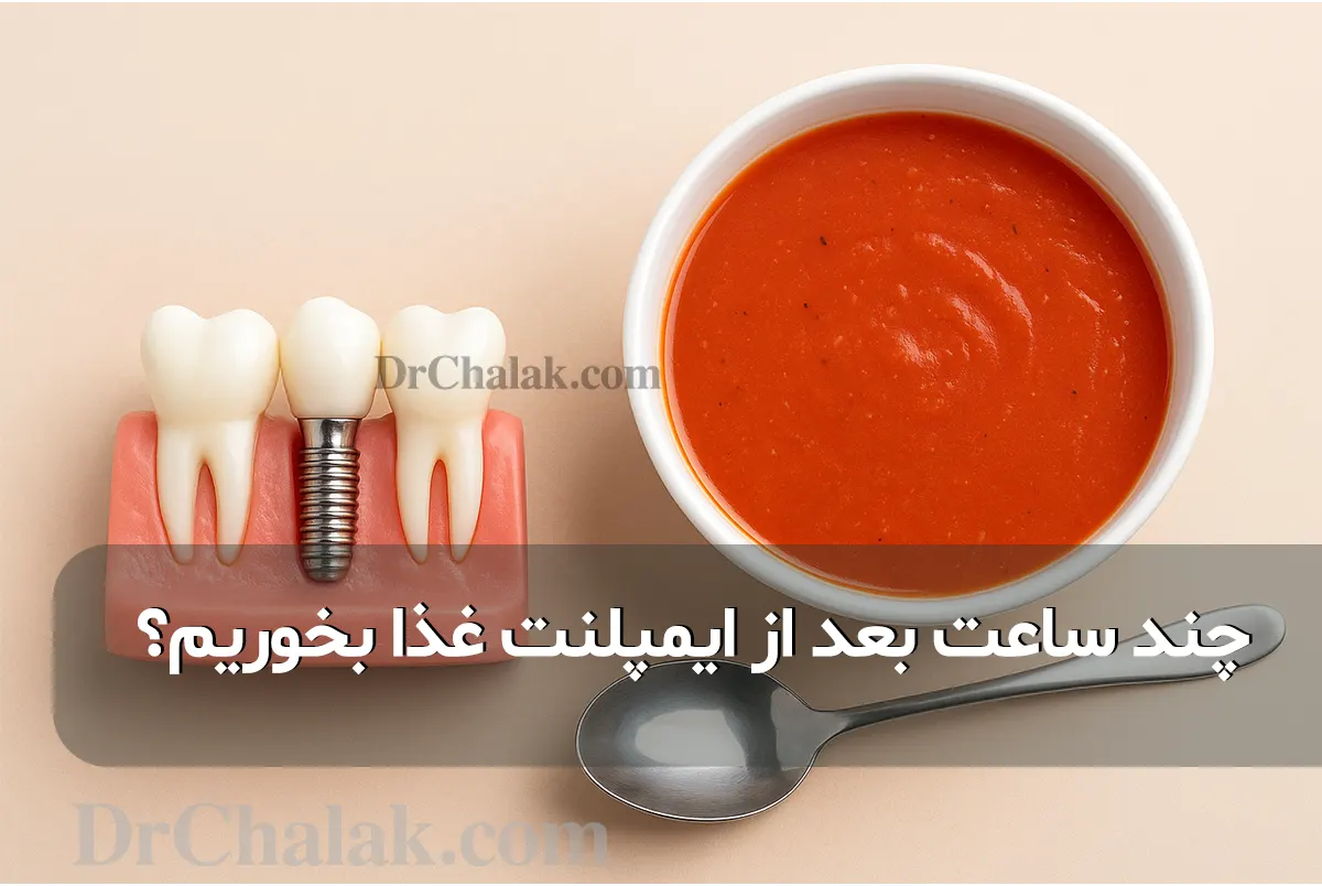 كم ساعة يجب أن نأكل بعد عملية الزرع؟ طبيب ذكي