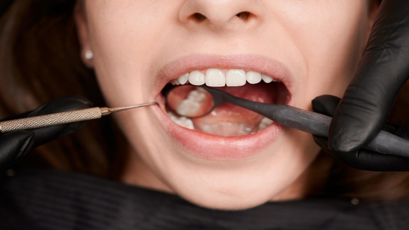 Front tooth extraction {steps, time and cost}