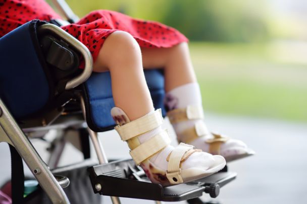 Choosing the most suitable brace for children with cerebral palsy