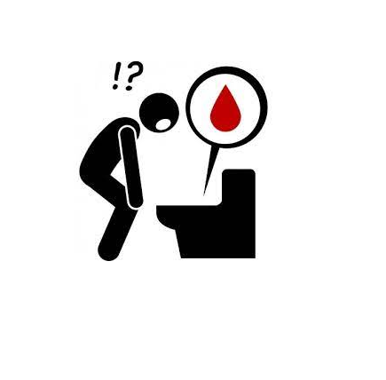 نزيف من فتحة الشرج - الدكتور كرامتي متخصص في جراحة القولون والمستقيم