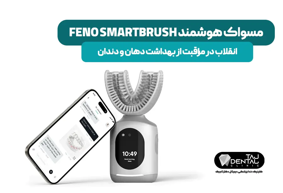 Feno Smartbrush - a revolution in oral health care