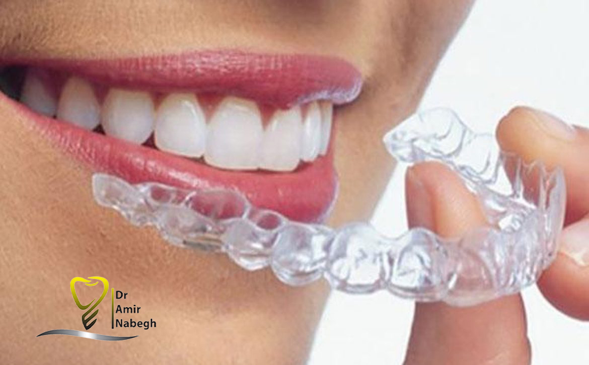 ما هو الحارس الليلي أو حارس الفم؟