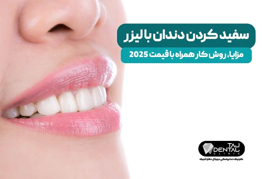 Teeth whitening with laser + price 2025