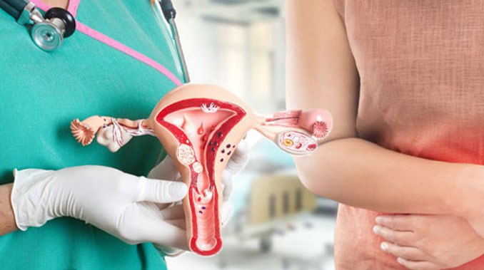 All About Transvaginal Laparoscopy: The Complete Guide to Minimally Invasive Surgery - Dr. Getty Standard