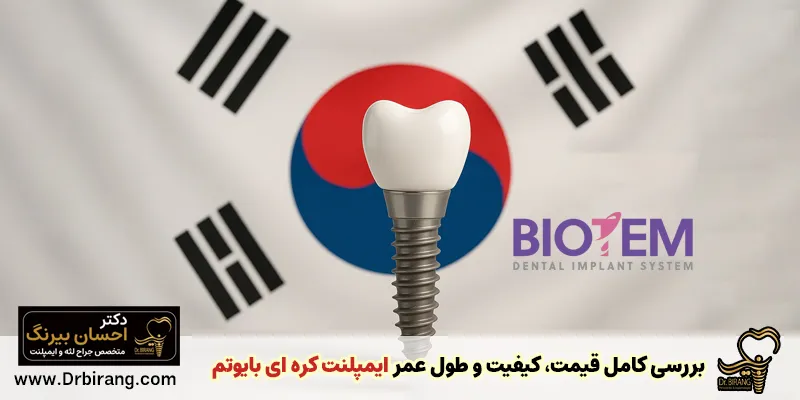 A complete review of the price, quality and longevity of biotem Korean implants - Dr. Ehsan Birang