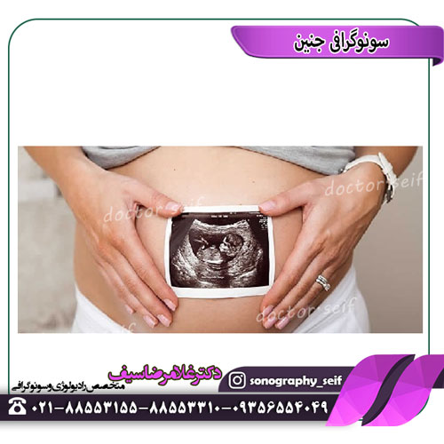 الموجات فوق الصوتية للجنين في طهران
