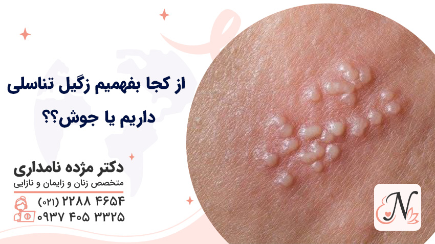 How do we know if we have genital warts or pimples?