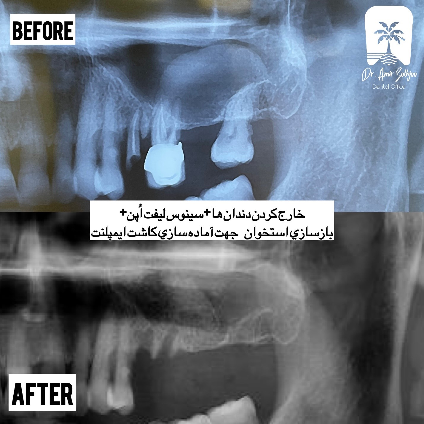 أفضل مركز لزراعة الأسنان في إيران: دليل لاختيار مركز أصيل لابتسامة دائمة