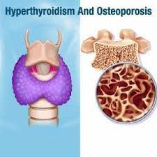 الدكتور صابر سادات أميني، أخصائي الغدة الدرقية والسكري في طهران
