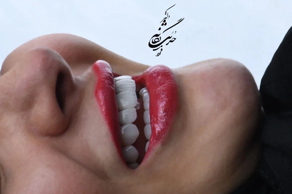 بهترین متخصص لمینت در پاسداران کلینیک تی دنتا تهران 1404