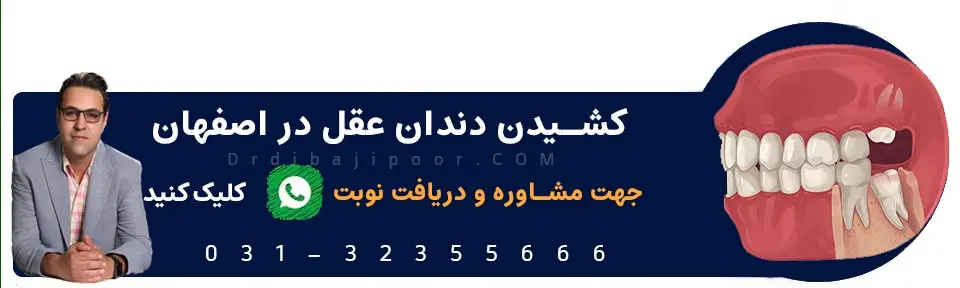 بهترین پزشک برای کشیدن دندان عقل در اصفهان بدون درد