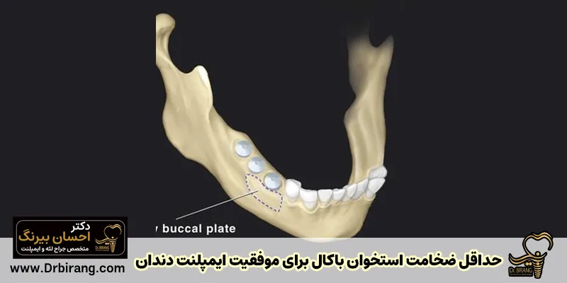 Minimum buccal bone thickness for dental implant success - Dr. Ehsan Birang