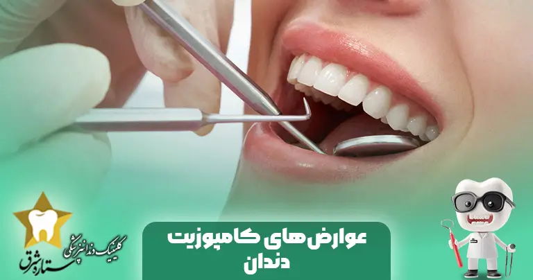 عوارض کامپوزیت دندان چه کسانی نباید کامپوزیت دندان انجام دهند؟