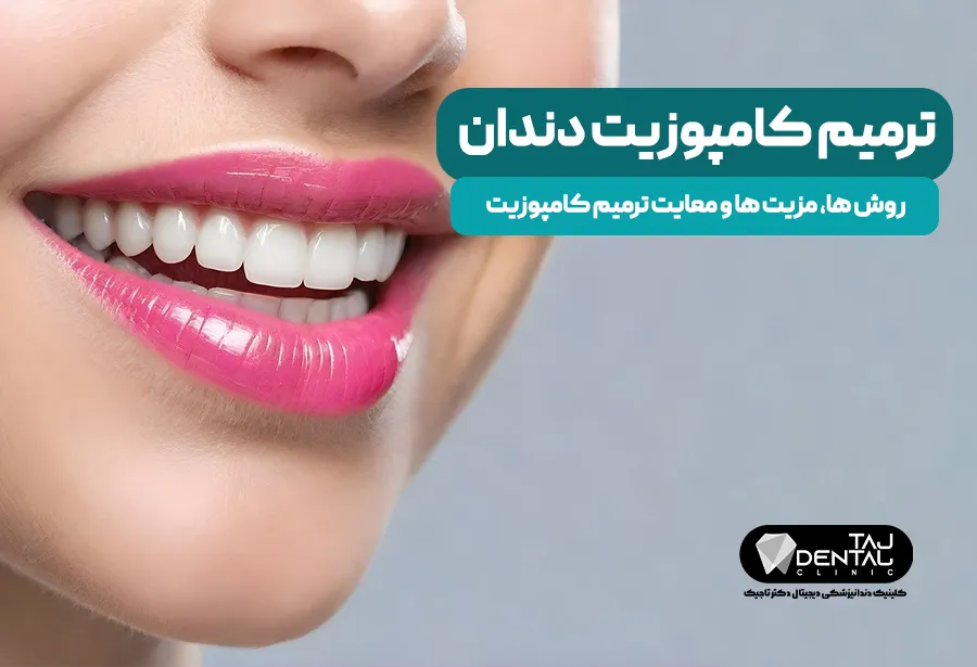 What is dental composite restoration and how is it done?