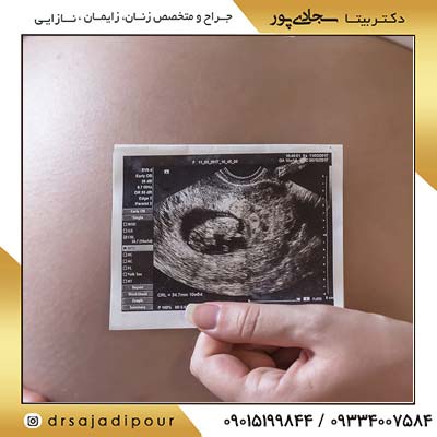 پریناتولوژی؛ شاخه ای حیاتی از پزشکی مادر و جنین