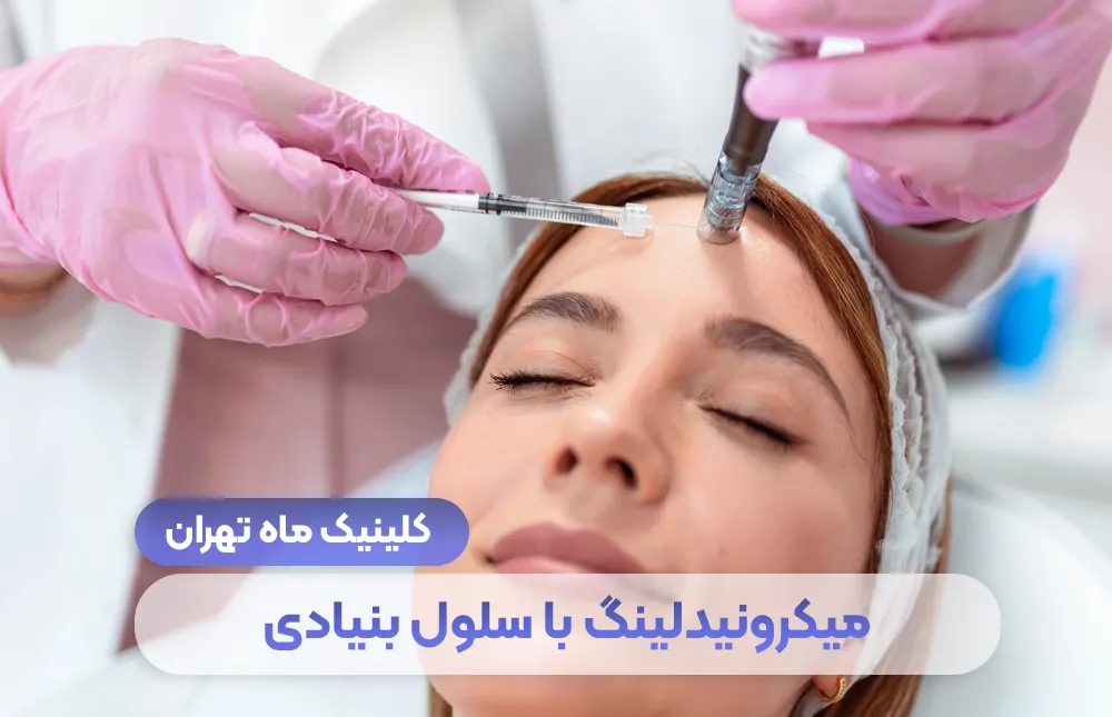 الوخز بالإبر الدقيقة بالخلايا الجذعية (الإكسوزوم) + تكلفتها في طهران - عيادة طهران ماه