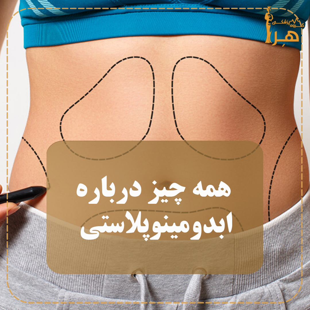 Everything about abdominoplasty surgery - Hera Medical Group