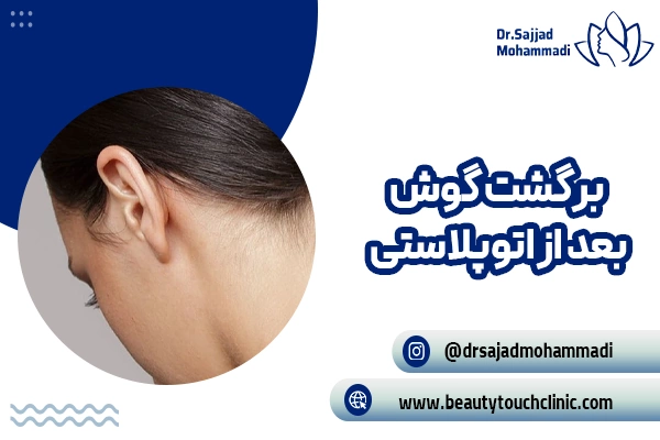 بازگشت گوش پس از جراحی اتوپلاستی؛ آیا گوش ها به حالت اولیه خود باز می گردند؟ (علل و پیشگیری)