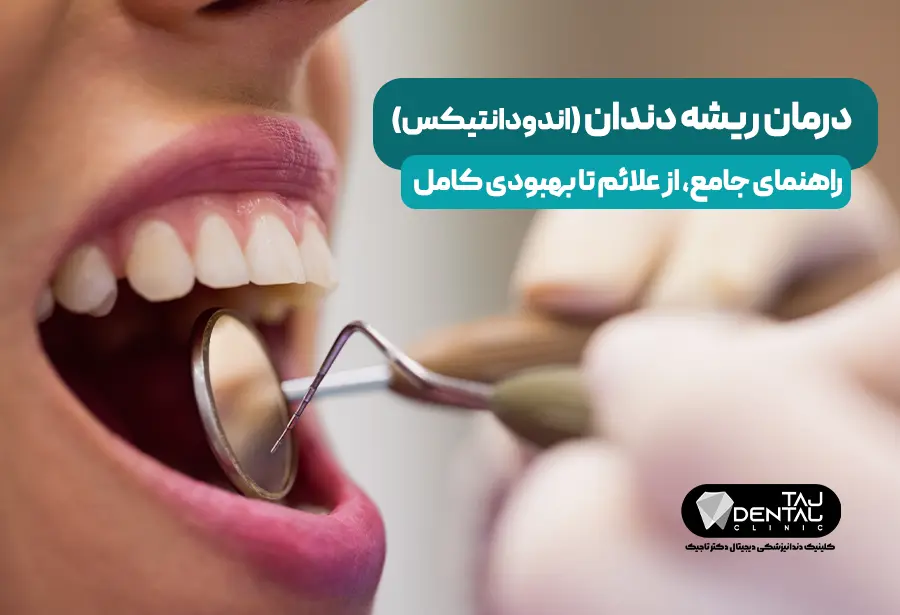 Root canal treatment Comprehensive guide + signs, steps and cost