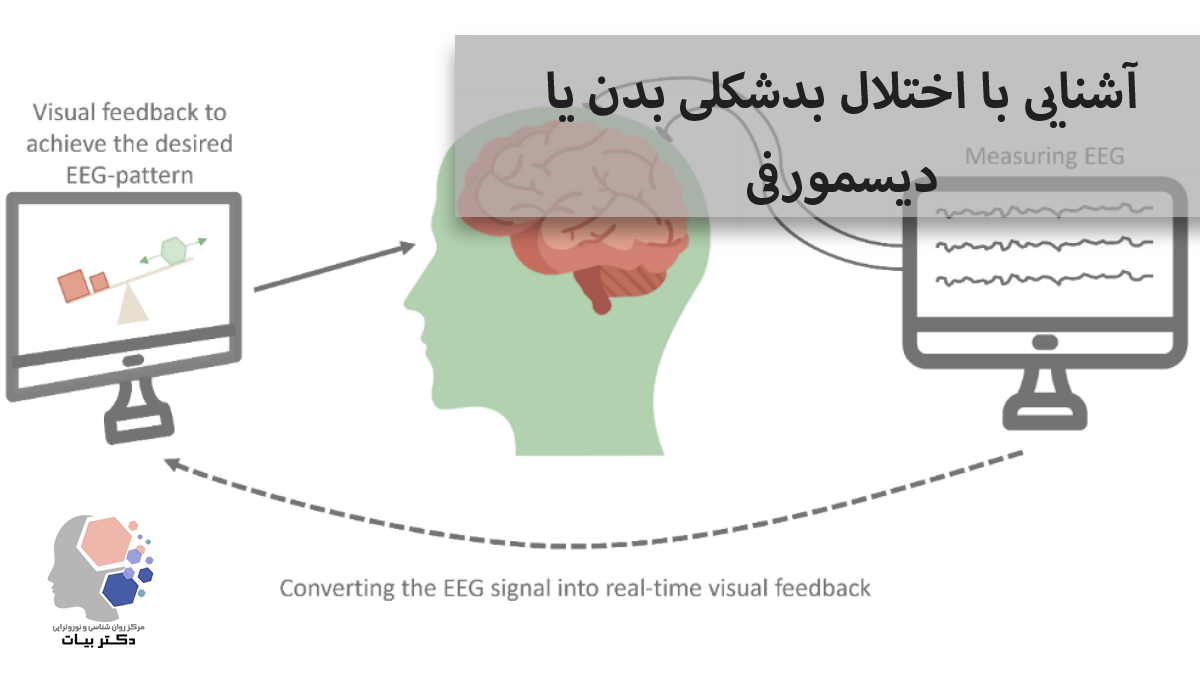 درمان میگرن با نوروفیدبک کاهش حملات با روش علمی بدون دارو - مرکز روانشناسی و نوروفیدبک دکتر بیات