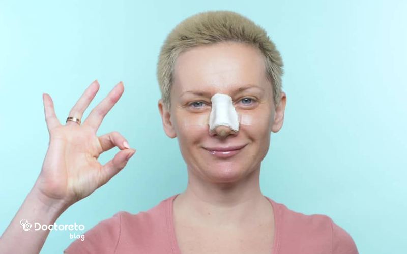 Why does bruising occur after nose surgery?