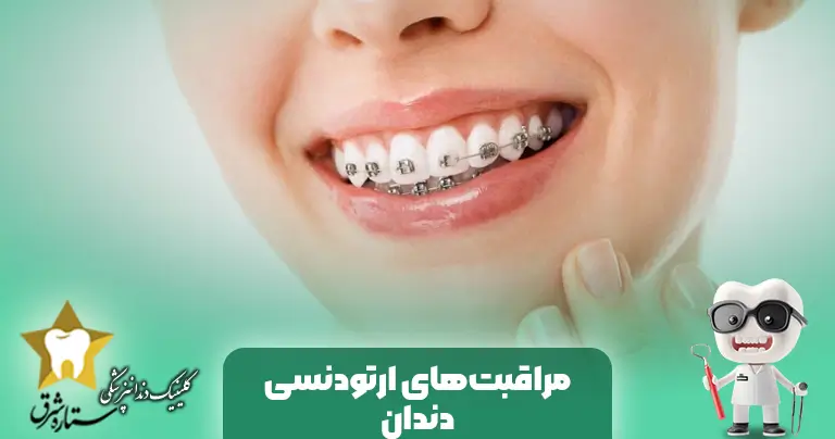 مراقبت های بعد از ارتودنسی دندان و مدت زمان درمان ارتودنسی