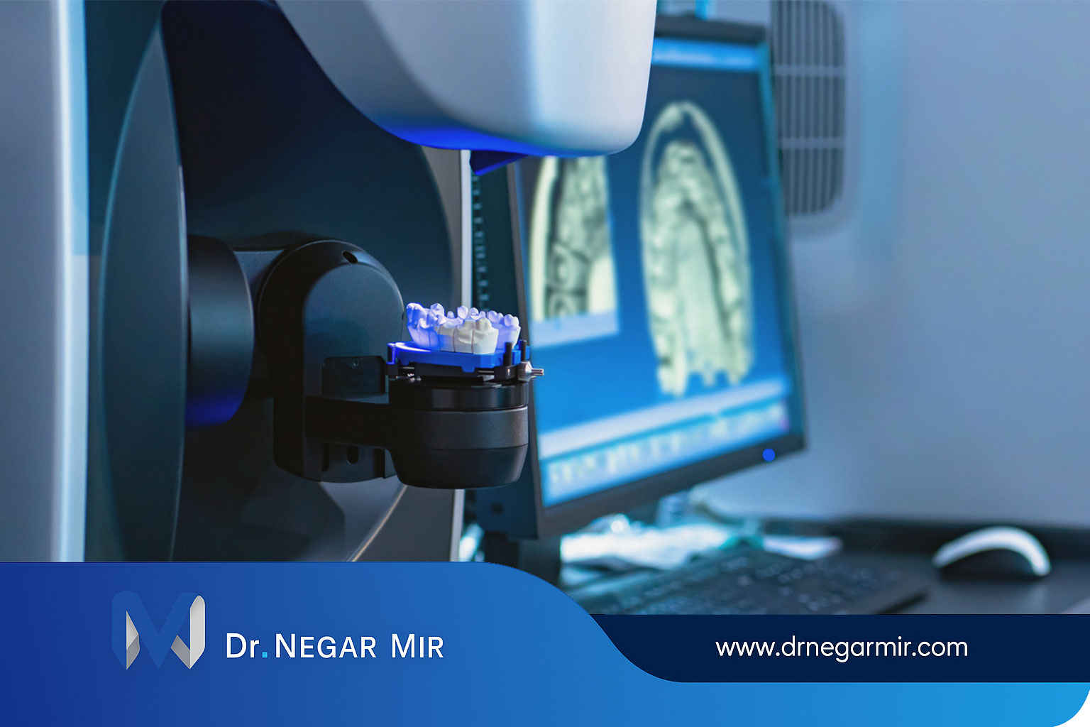 الزراعة الرقمية هي طريقة جديدة في طب الأسنان الرقمي في طهران 2025