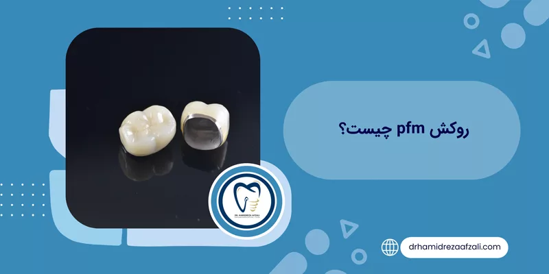 ما هو طلاء pfm؟ السعر + عينة طلاء pfm | دكتور حميدرضا أفضلي