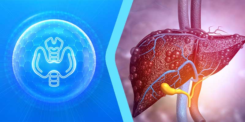 What is the relationship between hypothyroidism and fatty liver?