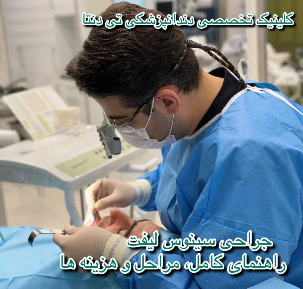 جراحی سینوس لیفت در تهران 1404 | دکتر علیرضا تسلیمی