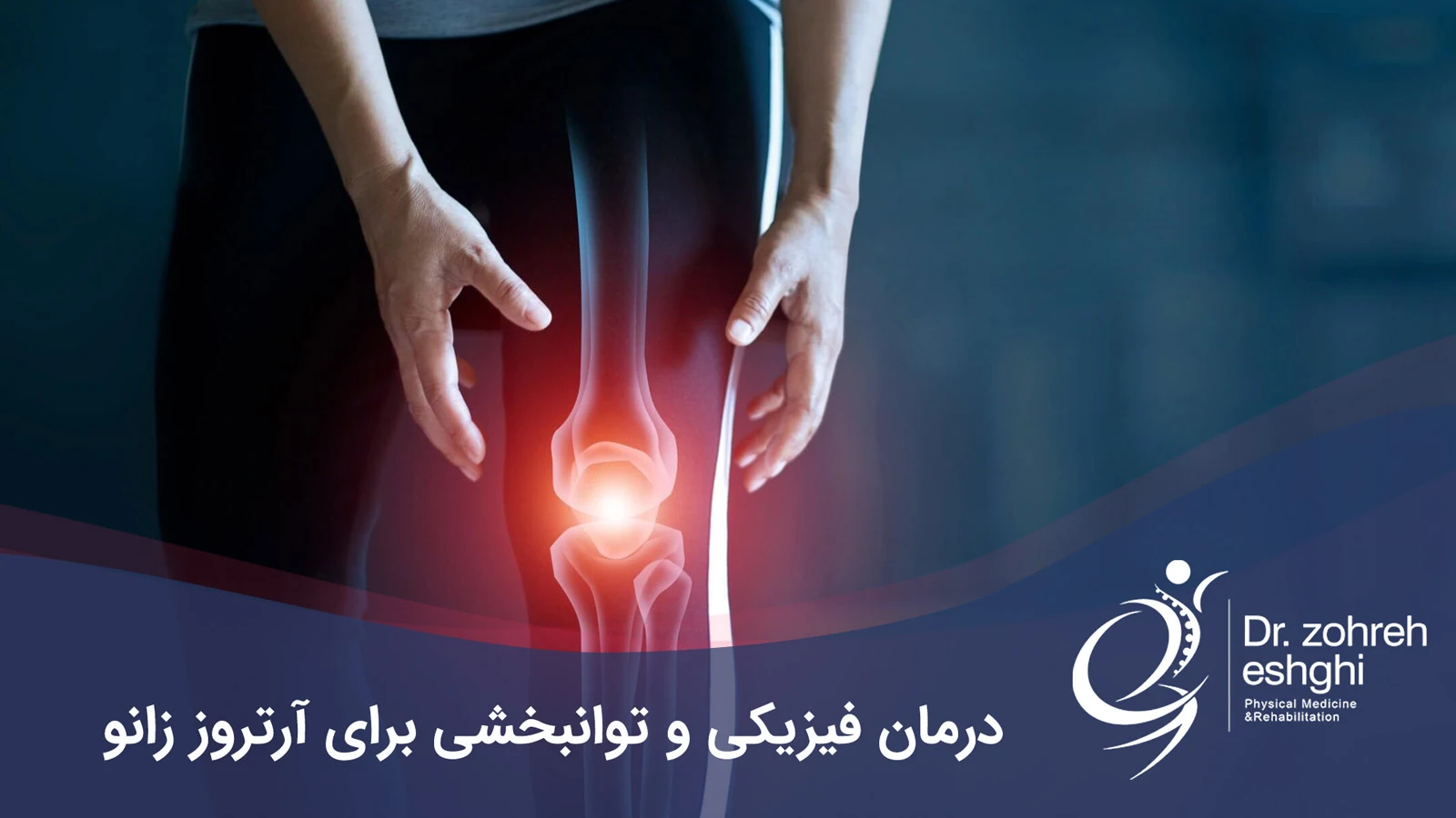 Physical therapy and rehabilitation for knee osteoarthritis