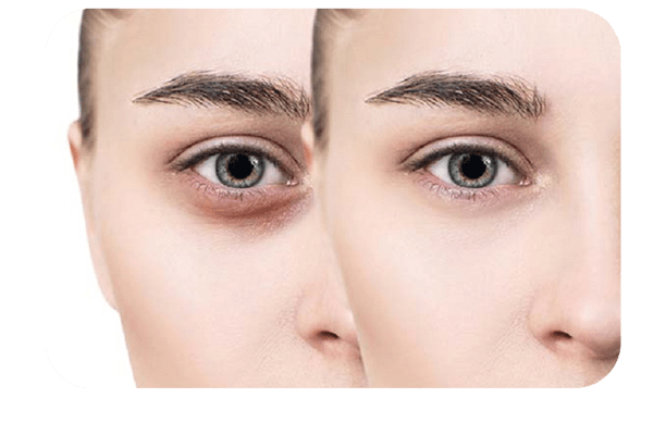 Carboxytherapy center in Zafar