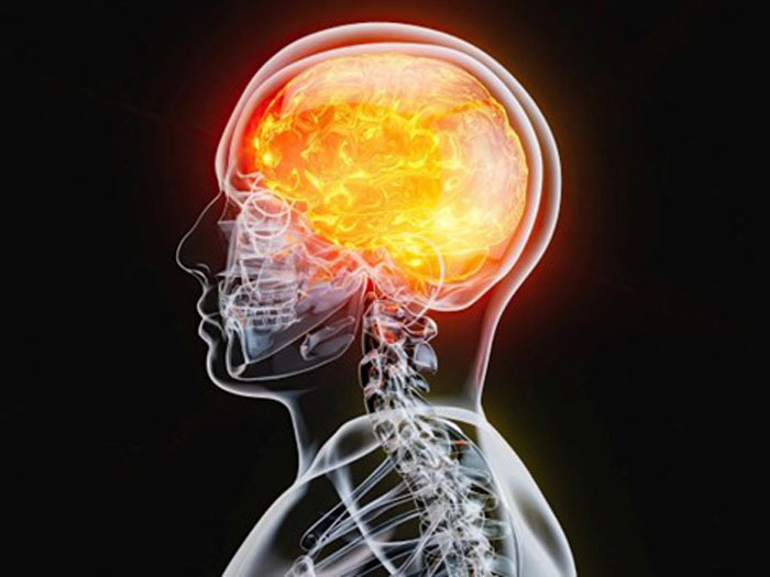 What is a brain injury? Its cause, symptoms, types and treatment methods Dr. Kihani Fard