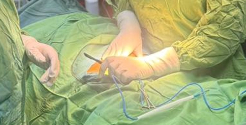 نقش جراحی در درمان سرطان دهانه رحم