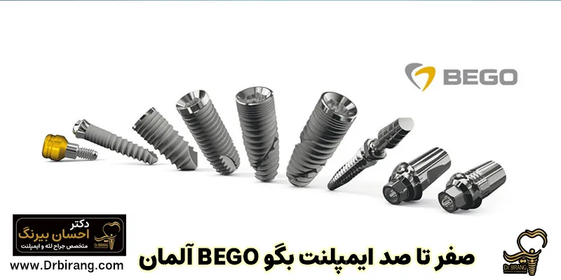 صفر تا 100 ایمپلنت می گویند BEGO آلمان + قیمت - دکتر احسان بیرنگ
