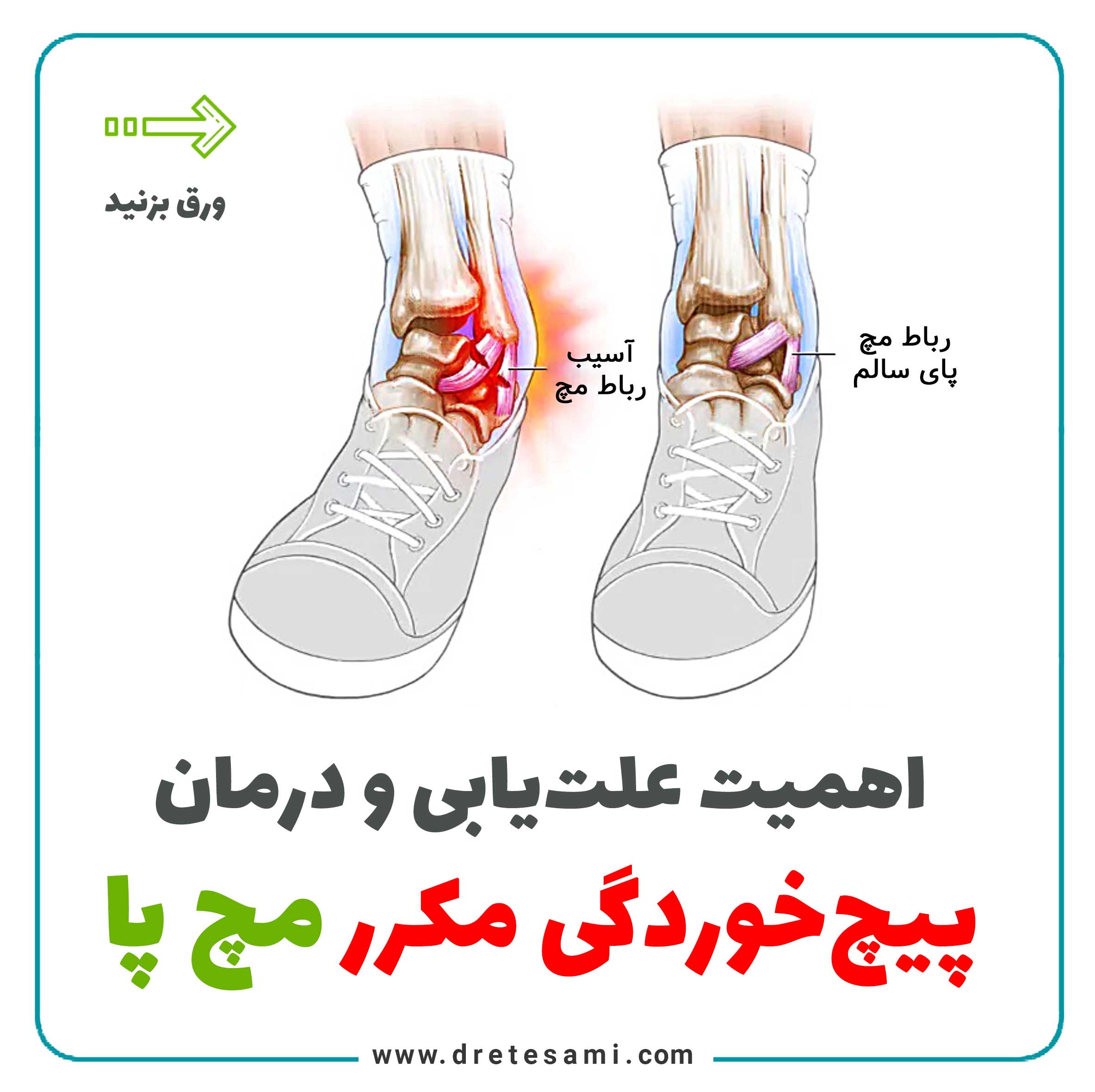 The importance of diagnosing and treating frequent ankle sprains